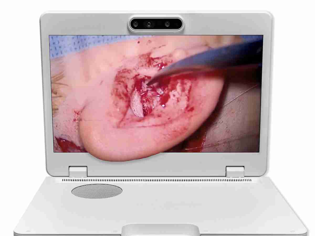 达擎之＂Heads-up 3D显微手术显示系统＂，，整合4K裸眼3D显示及眼球追踪系统，，具备快速追踪人眼移动位置功能，，减轻医师长时间维持固定姿势的负担，，，，让医师能有更宽广清晰的3D立体视野及更舒适的姿势来执行手术。。。。